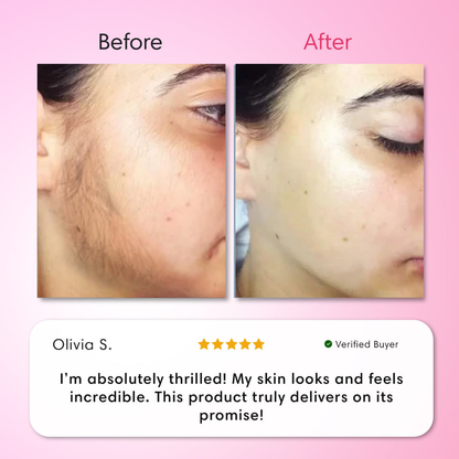 Hair Removal Trilogy Kit