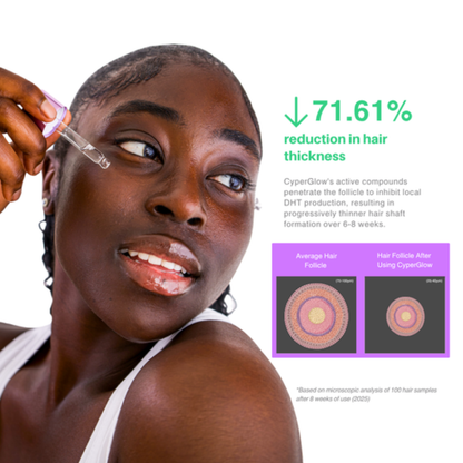 CyraGlow™ by Nelle