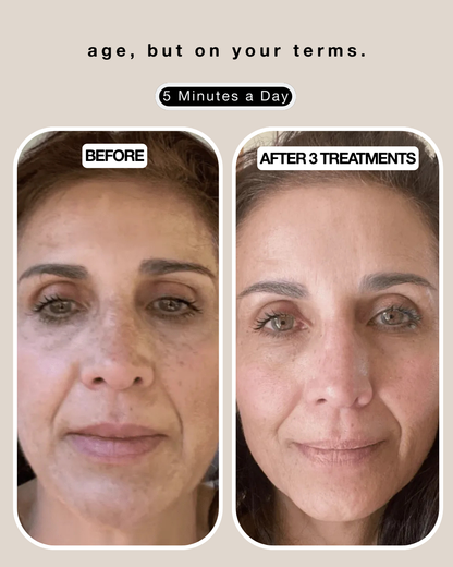 nelle® micro infusion system